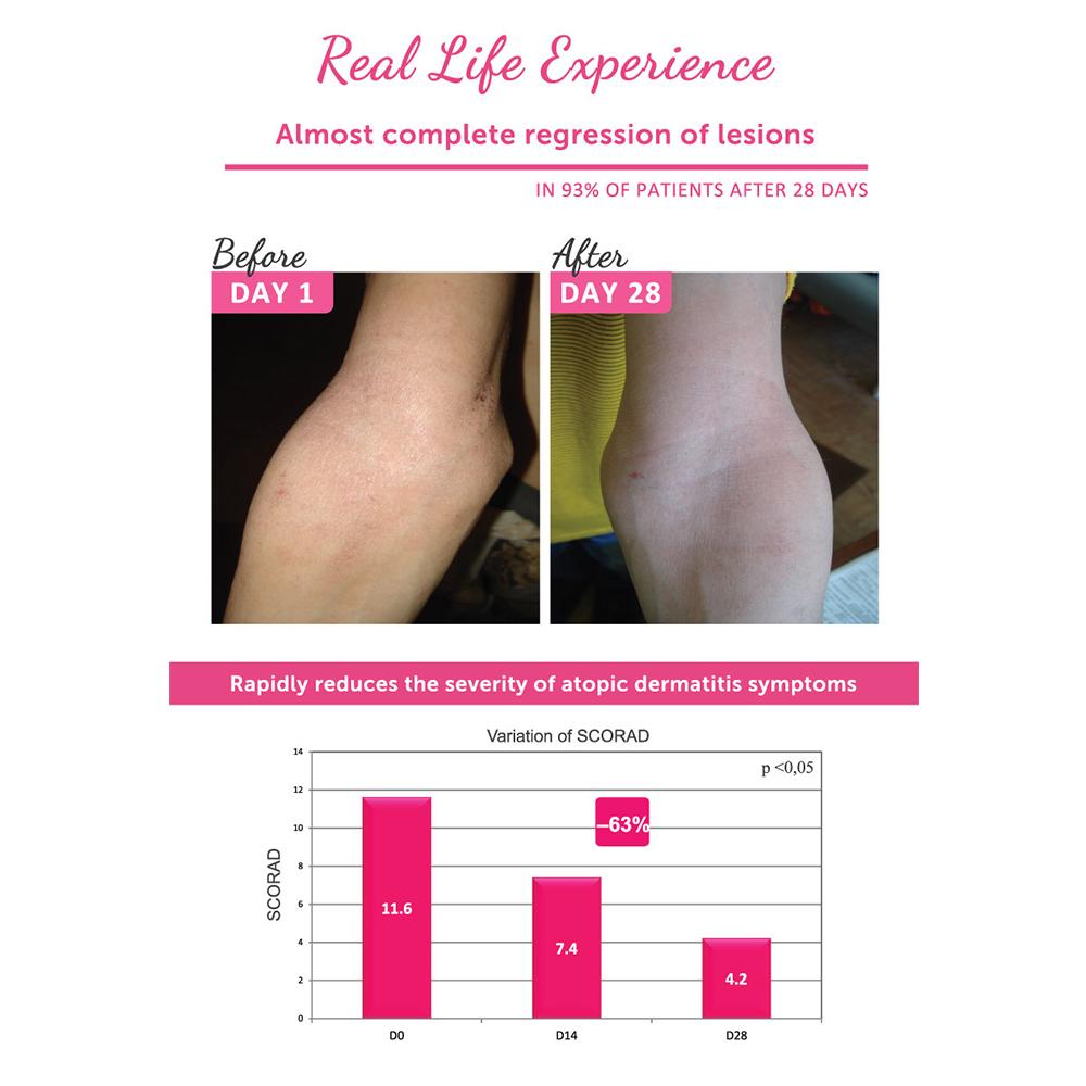Topicrem DA Emollient Balm