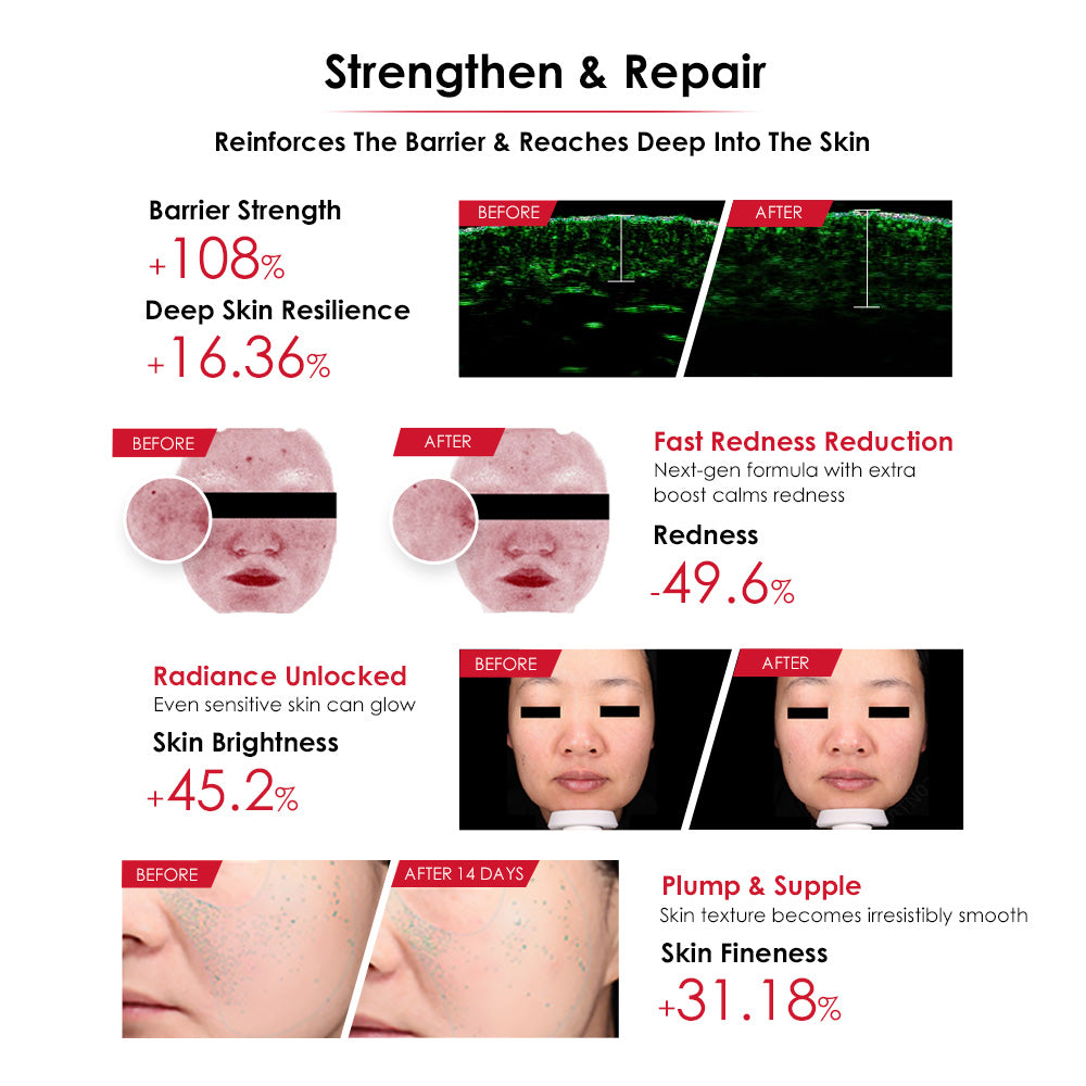 Winona Sensitiveness Relieving Moisturizing Tolerance-Extreme Essence 30ml