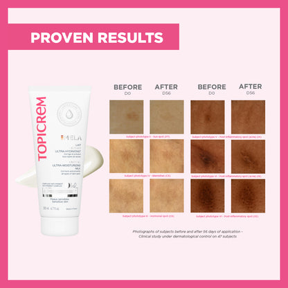 Topicrem MELA Unifying Ultra-Moisturizing Milk 200ml -(SPF 15)